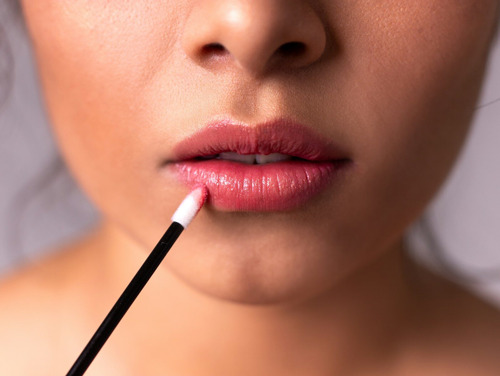 Lip fillers before and after