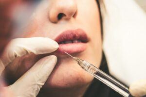 Filler vs Botox