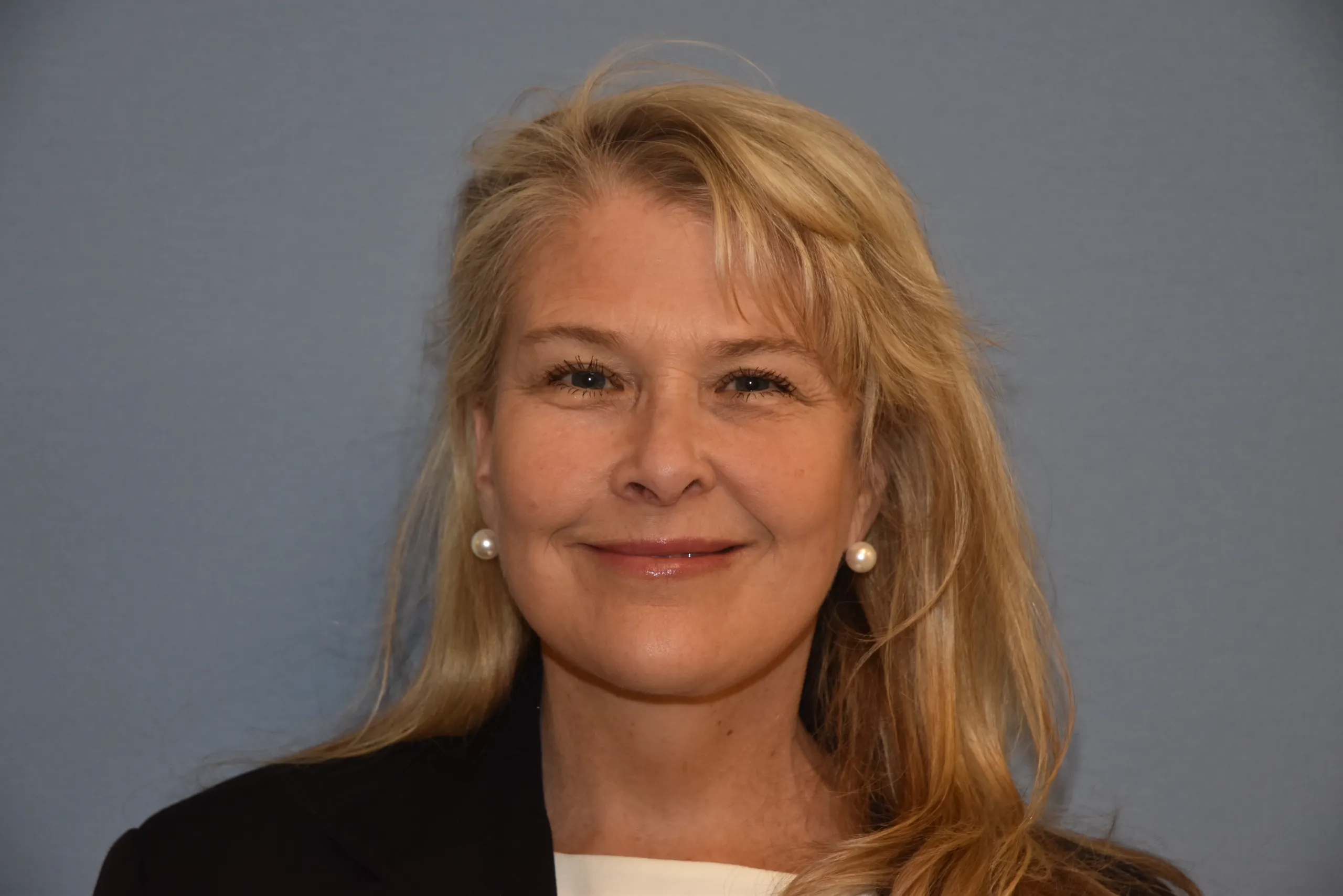 AFTER Facelift and neck lift - front view smiling